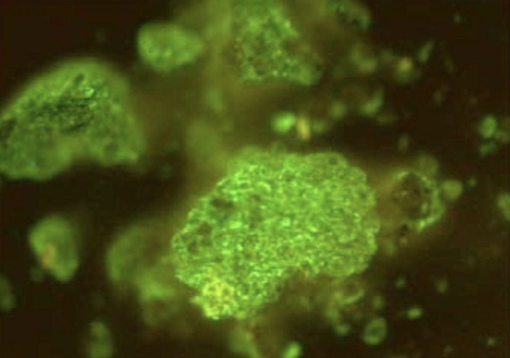 Glomalin-related soil protein (GRSP), revealed through a green dye