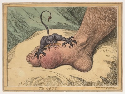 "The Gout," drawing by James Gillray